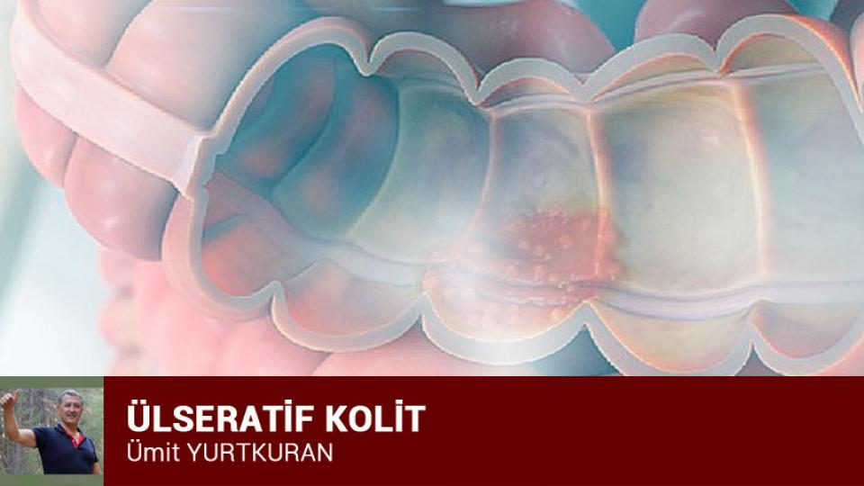 Tok Karınlarla (Şiş Göbeklerle) Açlıktan Ölüyoruz / Ümit YURTKURAN / ÜLSERATİF KOLİT / Ümit YURTKURAN